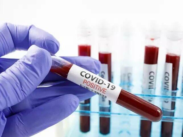 Coronavirus (Covid19)