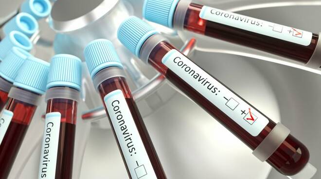 Coronavirus, covid19, test sierologico